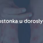 Close-up of adult hands and feet with red rash, viral infection symptoms, medical illustration, realistic style.