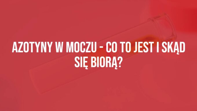 Medical test strip changing color, urine sample in a clear container, lab setting, scientific and clean, realistic.